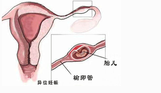 重度弱精症能否治愈