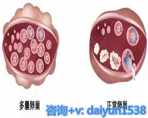 上海代怀生子胚胎移植(上海代孕需要哪些检查)